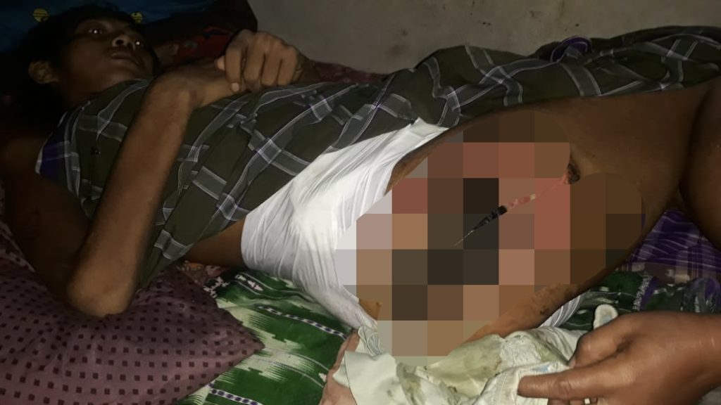 Tak Punya Biaya Untuk Berobat, Warga Sidomukti Merintih Kesakitan